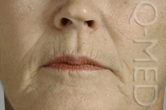 F_17152LIP.jpg