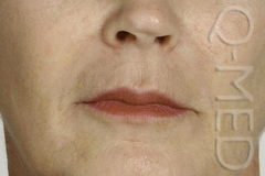 F_36173LIP.jpg