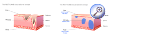 Tissue tailored product