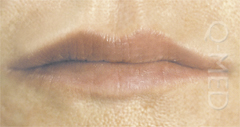 LIPS1_A.jpg