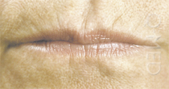 LIPS1_B.jpg