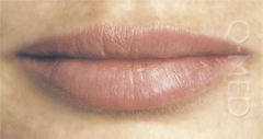 LIPS2_A.jpg