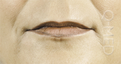 LIPS4_A.jpg