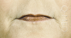 LIPS4_B.jpg