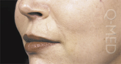 CHEEKS_A.jpg