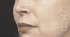 CHEEKS_B.jpg
